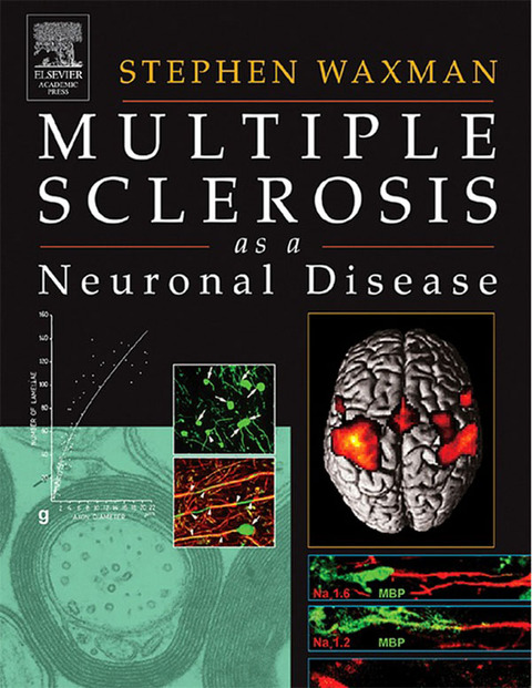 MULTIPLE SCLEROSIS AS A NEURONAL DISEASE