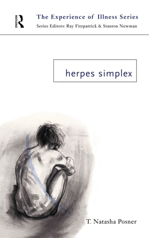 HERPES SIMPLEX