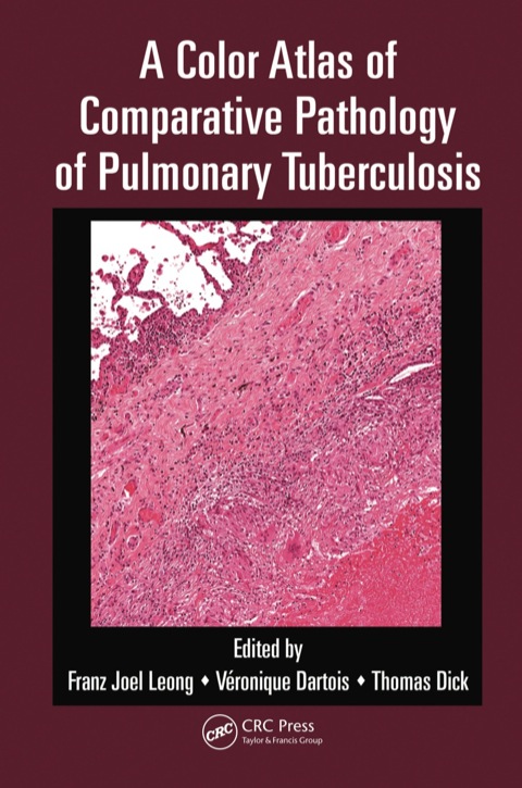 A COLOR ATLAS OF COMPARATIVE PATHOLOGY OF PULMONARY TUBERCULOSIS