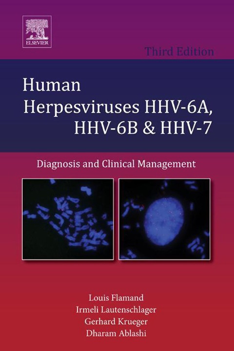 HUMAN HERPESVIRUSES HHV-6A, HHV-6B & HHV-7: DIAGNOSIS AND CLINICAL MANAGEMENT