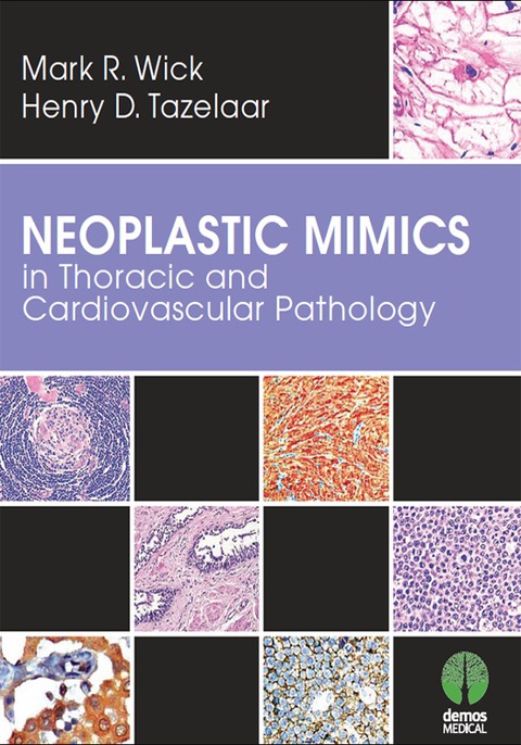 NEOPLASTIC MIMICS IN THORACIC AND CARDIOVASCULAR PATHOLOGY