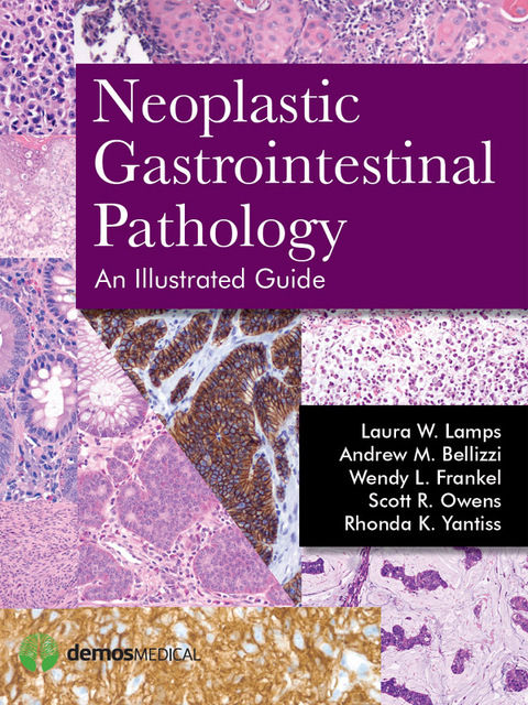 NEOPLASTIC GASTROINTESTINAL PATHOLOGY: AN ILLUSTRATED GUIDE