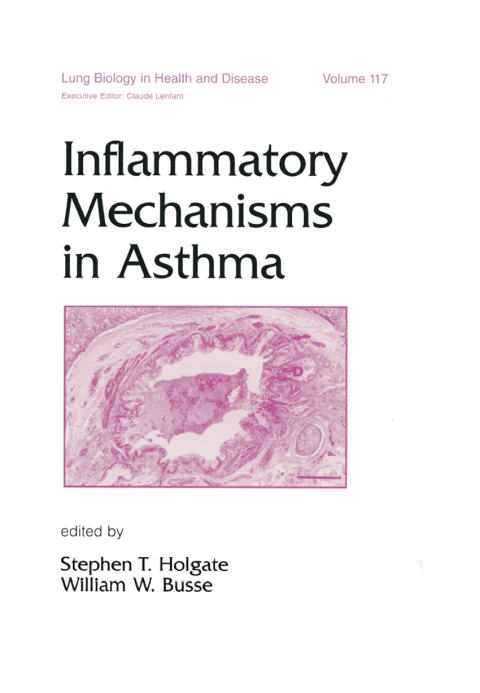 INFLAMMATORY MECHANISMS IN ASTHMA