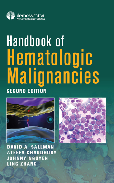 HANDBOOK OF HEMATOLOGIC MALIGNANCIES