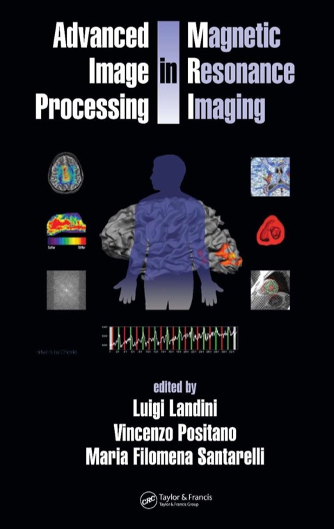 ADVANCED IMAGE PROCESSING IN MAGNETIC RESONANCE IMAGING