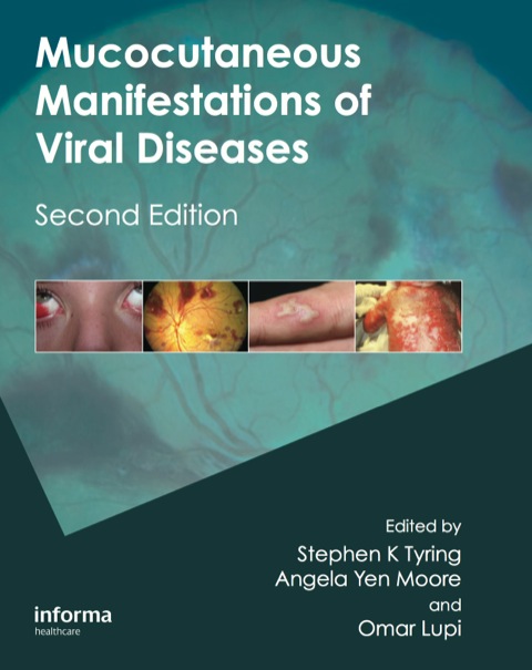 MUCOCUTANEOUS MANIFESTATIONS OF VIRAL DISEASES