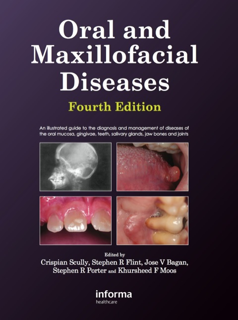 ORAL AND MAXILLOFACIAL DISEASES