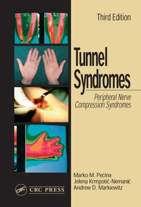 TUNNEL SYNDROMES