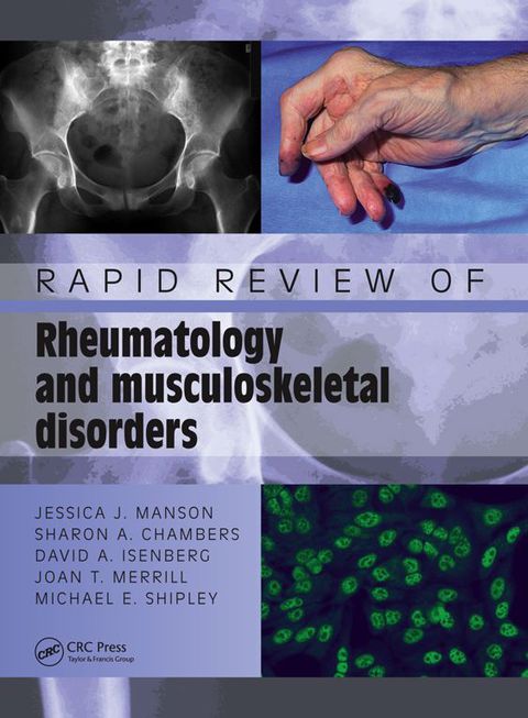 RAPID REVIEW OF RHEUMATOLOGY AND MUSCULOSKELETAL DISORDERS