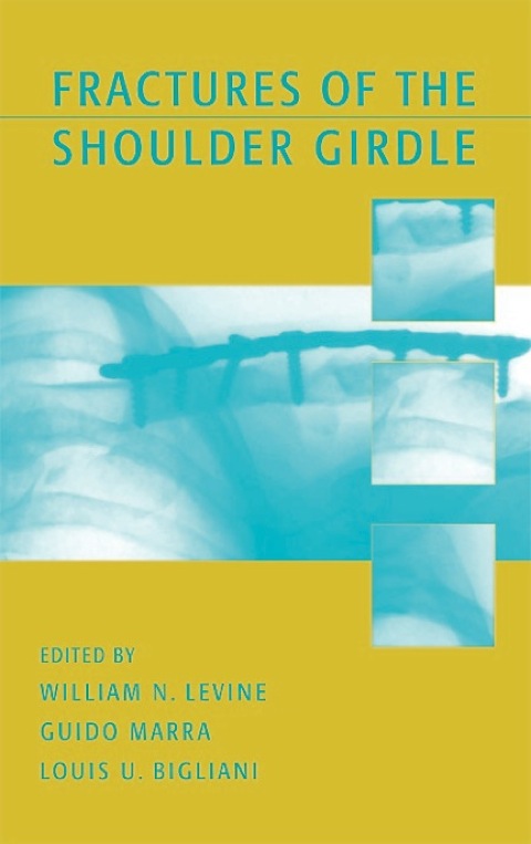 FRACTURES OF THE SHOULDER GIRDLE