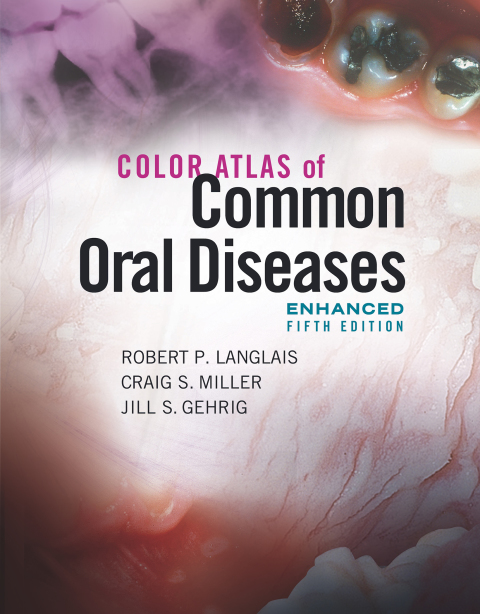 COLOR ATLAS OF COMMON ORAL DISEASES, ENHANCED EDITION