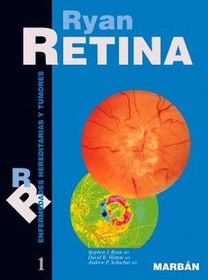 RETINA: TUMORES VOL. I (FLEXILIBRO)