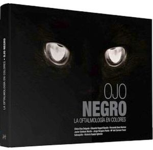 OJO NEGRO.  LA OFTALMOLOGA EN COLORES