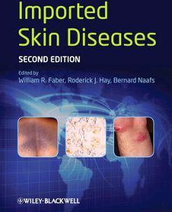 IMPORTED SKIN DISEASES 2ED.