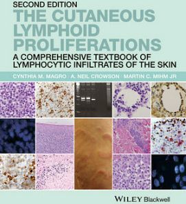 CUTANEOUS LYMPHOID PROLIFERATIONS: A COMPREHENSIVE TEXTBOOK OF