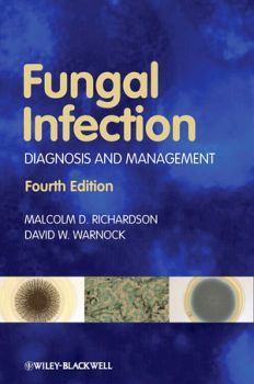 FUNGAL INFECTION 4ED.