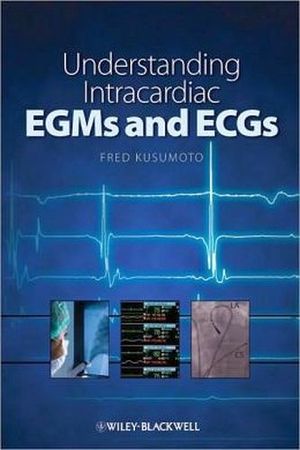 INTRACARDIAC ECGS AND EGMS