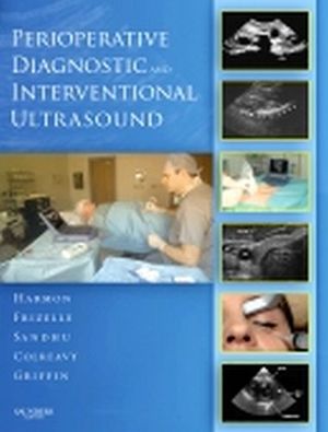 PERIOPERATIVE DIAGNOSTIC AND INTERVENTIONAL ULTRASOUND + DVD