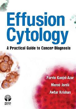 EFFUSION CYTOLOGY: A PRACTICAL GUIDE TO CANCER DIAGNOSIS