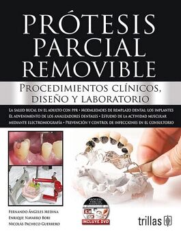 PRTESIS PARCIAL REMOVIBLE