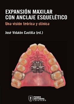 EXPANSI�N MAXILAR CON ANCLAJE ESQUEL�TICO