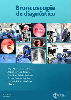 BRONCOSCOPIA DE DIAGN�STICO