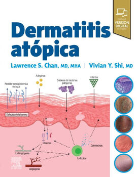 DERMATITIS ATPICA