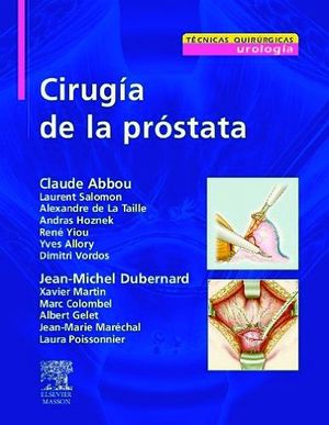 CIRUGIA DE LA PROSTATA