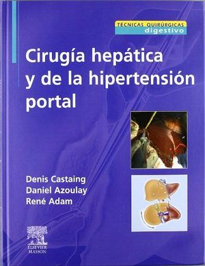 CIRUGIA HEPATICA Y DE LA HIPERTENSION PORTAL