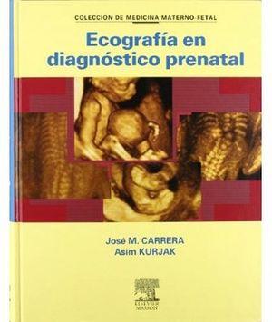 ECOGRAFIA EN DIAGNOSTICO PRENATAL