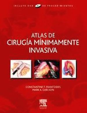 ATLAS DE CIRUGIA MINIMAMENTE INVASIVA C/DVD-ROM 2009