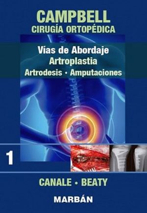 VIAS DE ABORDAJE ARTROPLASTIA (1) PREMIUM