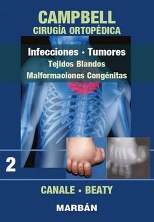 INFECCIONES Y TUMORES (2) PREMIUM