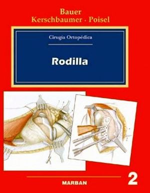 CIRUGIA ORTOPEDICA 2 