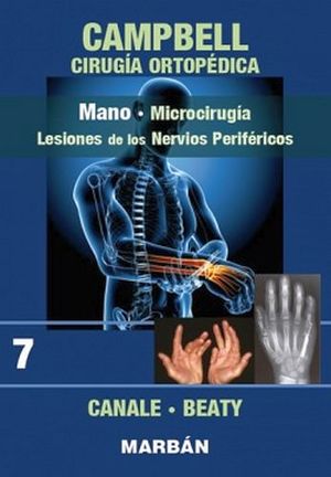 MANO -MICROCIRUGIA Y LESIONES NERVIOS PERIFERICOS- (7)