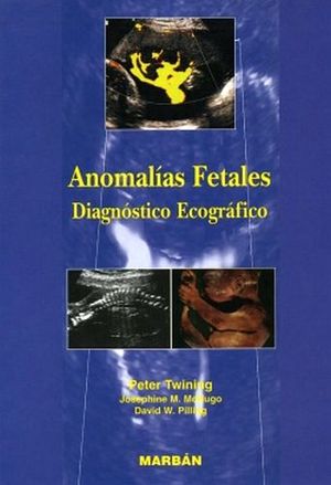 ANOMALIAS FETALES, DIAGNOSTICO ECOGRAFICO