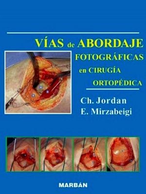 VIAS DE ABORDAJE FOTOGRAFICAS EN CIRUGIA ORTOPEDICA