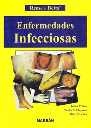 ENFERMEDADES INFECCIOSAS