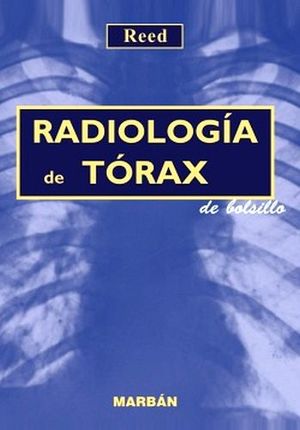RADIOLOG�A DEL T�RAX