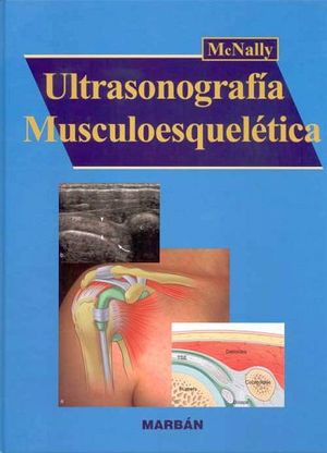 ULTRASONOGRAFA MUSCULOESQUELTICA
