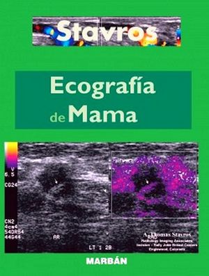 ECOGRAFIA DE MAMA