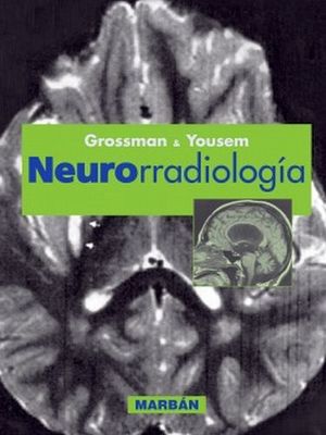 NEURORRADIOLOGA  (RESIDENTE 15)