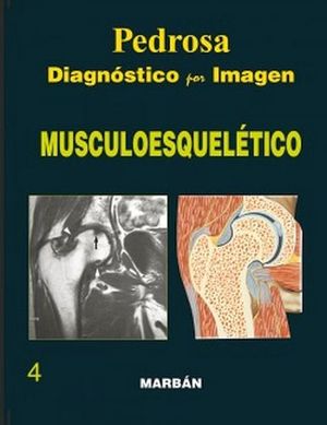DIAGNSTICO POR IMAGEN MUSCULOESQUELTICO GRAN FORMATO