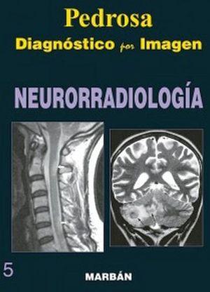 DIAGNSTICO POR IMAGEN NEURORRADIOLOGA (GRAN FORMATO)