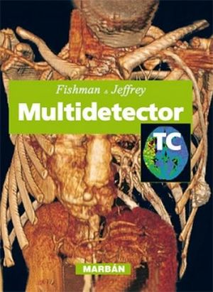 TC MULTIDETECTOR (FLEXILIBRO)