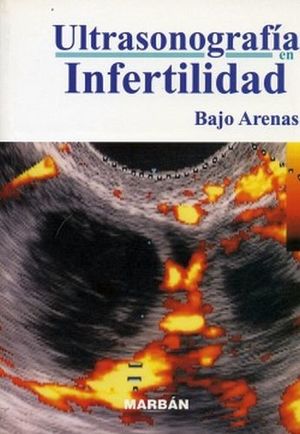 ULTRASONOGRAFIA EN INFERTILIDAD (BOLSILLO 13)