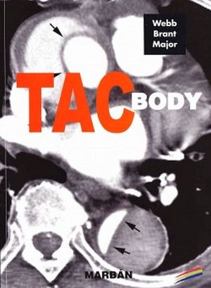 FUNDAMENTOS DE TAC BODY -RESIDENTE 15-