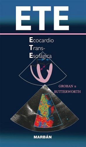 ECOCARDIO TRANS-ESOFAGICA