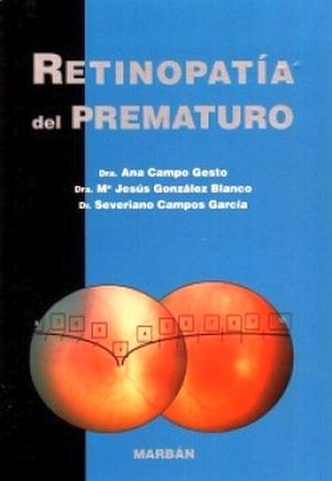 RETINOPATIA DEL PREMATURO