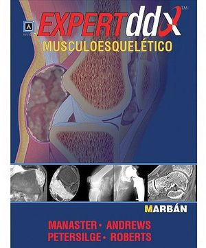 EXPERTDDX MUSCULOESQUELTICO 